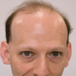 Joel Sherman
